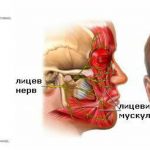 БЕЛОВА ПАРАЛИЗА ИЛИ ПАРЕЗА НА ЛИЦЕВИОТ НЕРВ